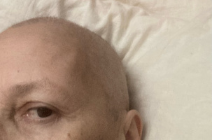 Celline Gacon, à l'hôpital Nord (42), se bat contre son cancer et celui de la démocratie.