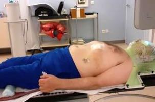 Jean-Pierre Mille allongé sur la table de radiothérapie pendant une séance de rayons.